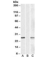 Western blot of HEK293 lysate overexpressing human DYDC1-MYC lysate (Lane A) and mock-transfected ly