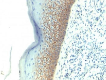 E-Cadherin Antibody / CDH1