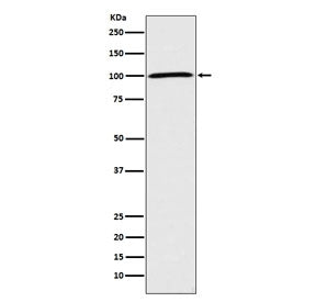 Western blot testing of human HeLa cell lysate with ATP1A1 antibody. Predicted molecular weight ~113