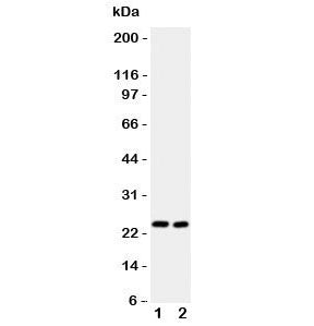Western blot testing of IL6 antibody and Lane 1: mouse HEPA1-6; 2: (m) NIH3T3 lysate. Expected molec