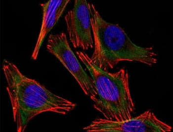 S100B Antibody Cocktail