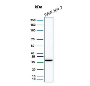 Western blot testing of mouse RAW264.7 cell lysate with HBEGF antibody. Predicted molecular weight ~