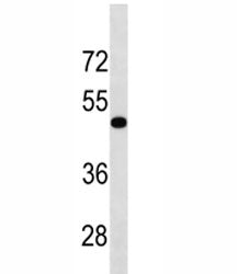 TGFBR1 Antibody