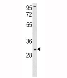 SOD3 Antibody