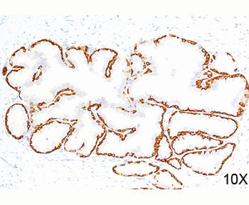 Cytokeratin 14 Antibody / CK14 / KRT14