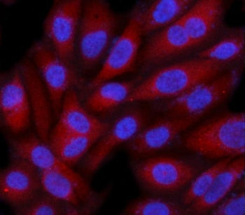 SMG9 Antibody / C19orf61