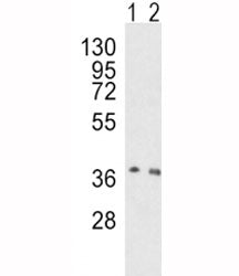Western blot analysis of OGG1 antibody and human HeLa (lane 1), mouse NIH3T3 (2) lysate. Predicted m