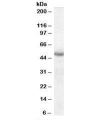Western blot testing of human brain lysate with Neuroserpin antibody at 1ug/ml. Predicted molecular 