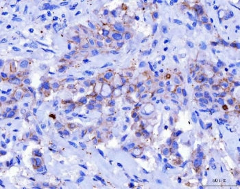 DSG2 Antibody / Desmoglein 2
