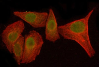 Immunofluorescent staining of FFPE human SiHa cells with IKB zeta antibody (green) and Beta Tubuliln