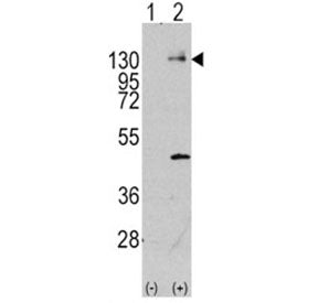 Western blot analysis of PDGFR antibody and 293 cell lysate (2 ug/lane) either nontransfected (Lane 
