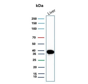 Western blot testing of human liver tissue lysate with Liver Arginase antibody (clone ARG1/9447). Pr