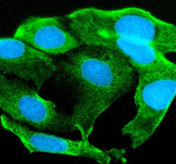 Immunofluorescent staining of STYK1 using anti-STYK1 antibody. STYK1 was detected in an immunocytoch