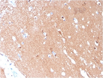 IHC staining of FFPE human brain with TUBB3 antibody (TUBB3/3731). HIER: boil tissue sections in pH 