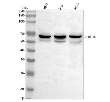Western blot analysis of PFKFB4 using anti-PFKFB4 antibody. Lane 1: human 293T whole cell lysates, L