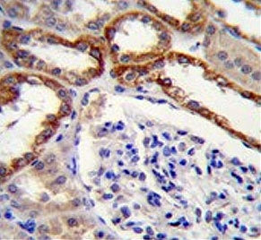 IHC testing of FFPE human kidney tissue with Prolyl-tRNA synthetase antibody. HIER: steam section in