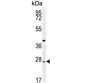 Western blot testing of human WiDr cell lysate with DIRAS3 antibody. Predicted molecular weight ~26 