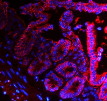 Immunofluorescent staining of FFPE mouse intestine with Epcam antibody (red) and DAPI nuclear stain 