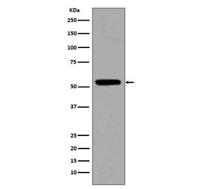 Western blot testing of lysate from human HeLa cells treated with Trichostatin A, with acetyl-p53 an