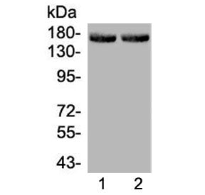 Western blot testing of 1) rat liver and 2) mouse liver lysate wtih MED14 antibody at 0.5ug/ml. Expe