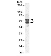 Western blot testing of 293 lysate with PPP2R5D antibody at 2ug/ml. Image shows isoforms of ~70kDa a
