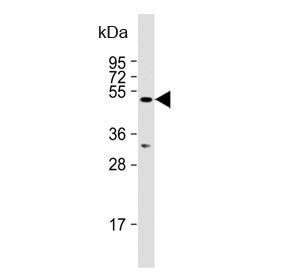 Western blot testing of human HeLa cell lysate with AMSH-like protease antibody. Predicted molecular