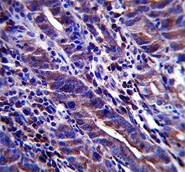 MUC-1 antibody immunohistochemistry analysis in formalin fixed and paraffin embedded human stomach t