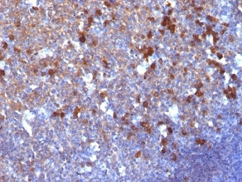 IgG Heavy Chain Antibody