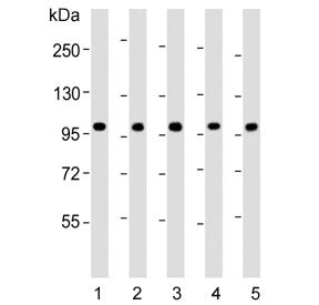 Western blot testing of human 1) CCRF-CEM, 2) Jurkat, 3) liver, 4) MCF7 and 5) HL60 lysate with RSBN