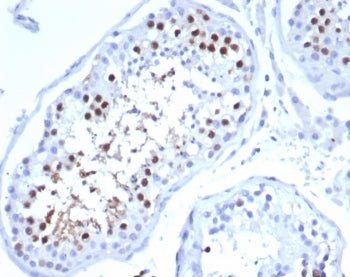KIF2C Antibody / MCAK