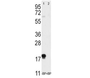 Western blot analysis of Thy1 antibody pre-incubated without (Lane 1) and with (2) blocking peptide 