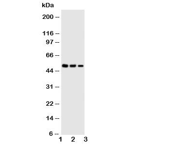 Western blot testing of Kallistatin antibody and Lane 1: SMMC-7721; 2: COLO320; 3: Jurkat cell lysat