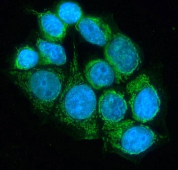 DLD Antibody