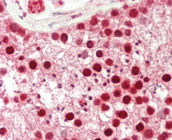 IHC testing of FFPE human testis tissue with CDK14 antibody. HIER: steam section in pH6 citrate buff