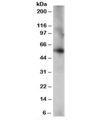CORO1C Antibody