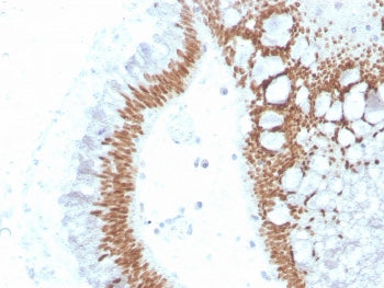 SATB2 Antibody