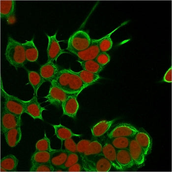 Immunofluorescent staining of fixed human MCF7 cells with Cytokeratin 8 antibody (clone SPM538, gree