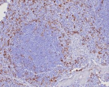 IHC staining of FFPE human tonsil tissue with CD162 antibody (clone PSGL1/8135R). HIER: boil tissue 