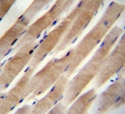 RHEB antibody immunohsitochemistry analysis in formalin fixed and paraffin embedded human skeletal m