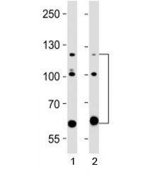 ABL2 Antibody