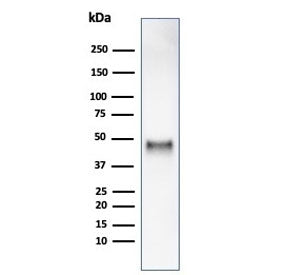 Western blot testing of human HCT116 cell lysate using recombinant Cyclin E1 antibody (clone rCCNE1/
