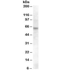 Western blot testing of rat retina lysate with RPE65 antibody at 0.5ug/ml. Predicted molecular weigh