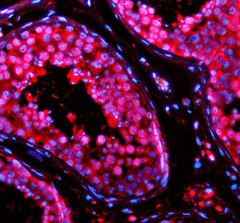 Immunofluorescent staining of TSN using anti-Translin antibody (red). TSN was detected in a paraffin