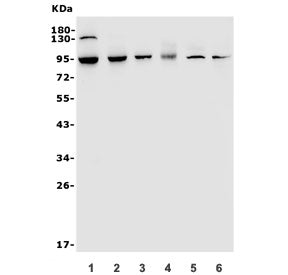Western blot testing of 1) human A549, 2) human A431, 3) rat brain, 4) mouse brain, 5) mouse heart a
