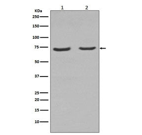 Western blot testing of rat 1) C6 and 2) PC-12 cell lysate with p75NTR antibody. Expected molecular 
