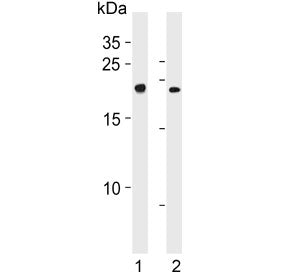 Western blot testing of 1) human K562 and 2) mouse lung lysate with CBFB antibody. Predicted molecul