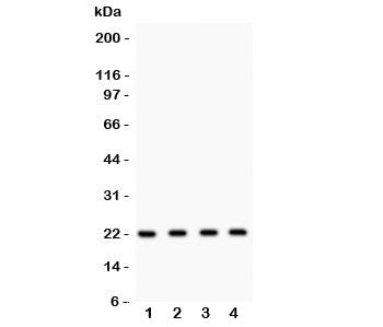 Western blot testing of Securin antibody and Lane 1: HeLa; 2: MCF-7; 3: SKOV; 4: A375 lysate. Predic