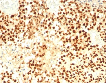 Steroidogenic Factor 1 Antibody / SF-1 / NR5A1