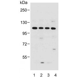 GAA Antibody / Glucosidase alpha acid