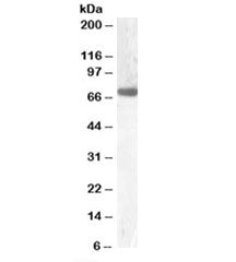 Western blot testing of rat liver lysate with GCKR antibody at 0.1ug/ml. Predicted molecular weight 